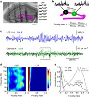  Distance-dependent inhibition supports focality of gamma oscillations. 