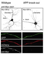 Complex formation of APP with GABAB receptors links axonal trafficking to amyloidogenic processing