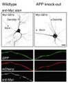 Complex formation of APP with GABAB receptors links axonal trafficking to amyloidogenic processing
